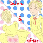 Before and After (Gentle Love)